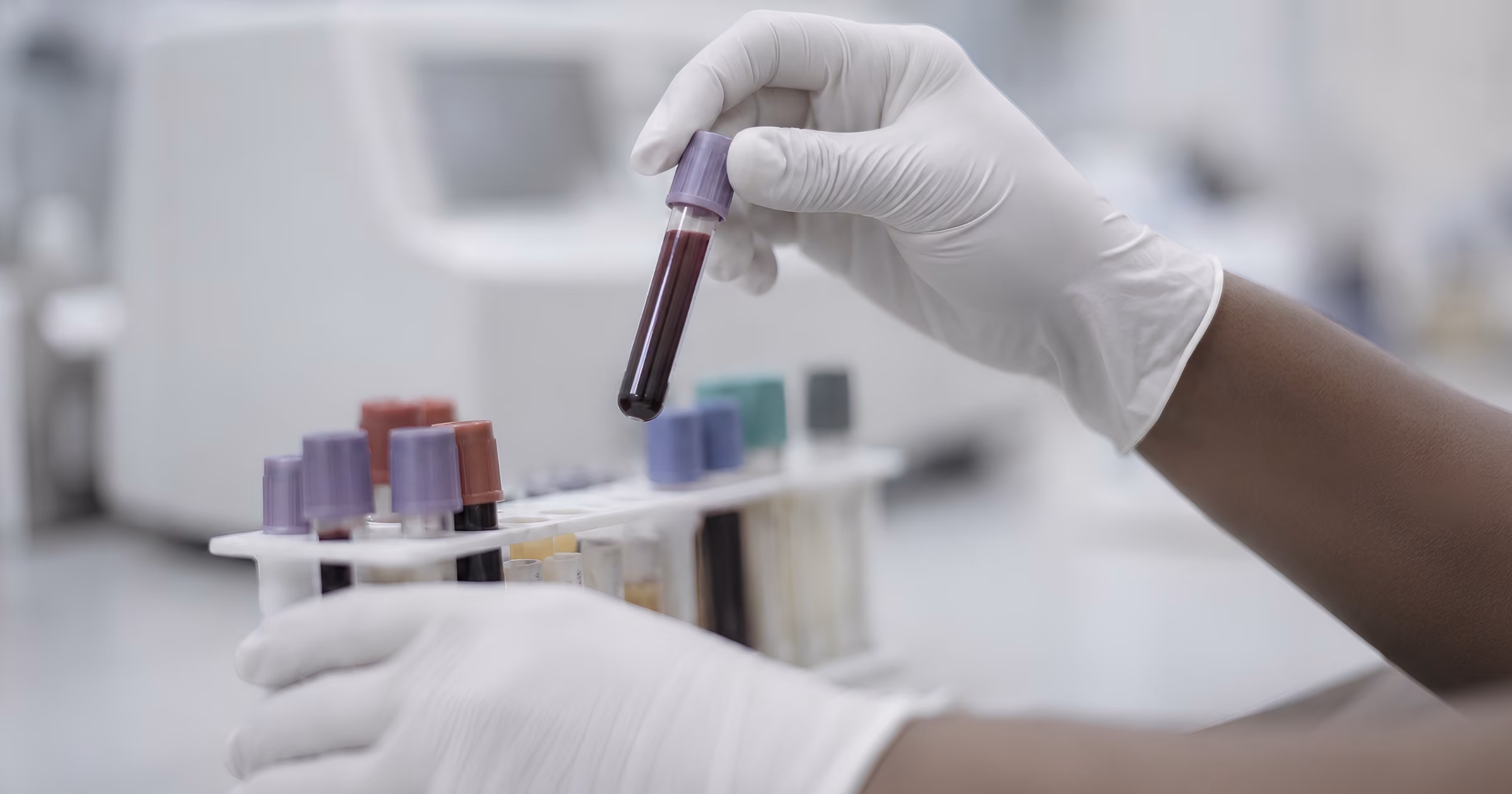 hepatitis A testing at DocTap