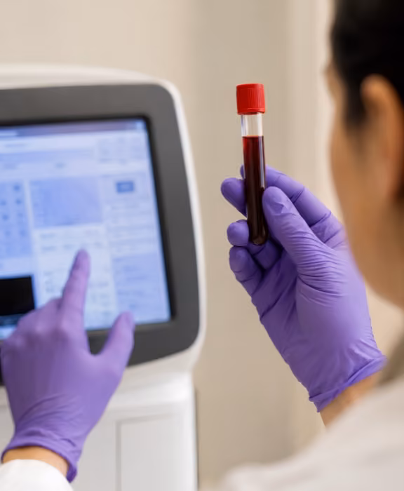 Private ferritin blood test in London