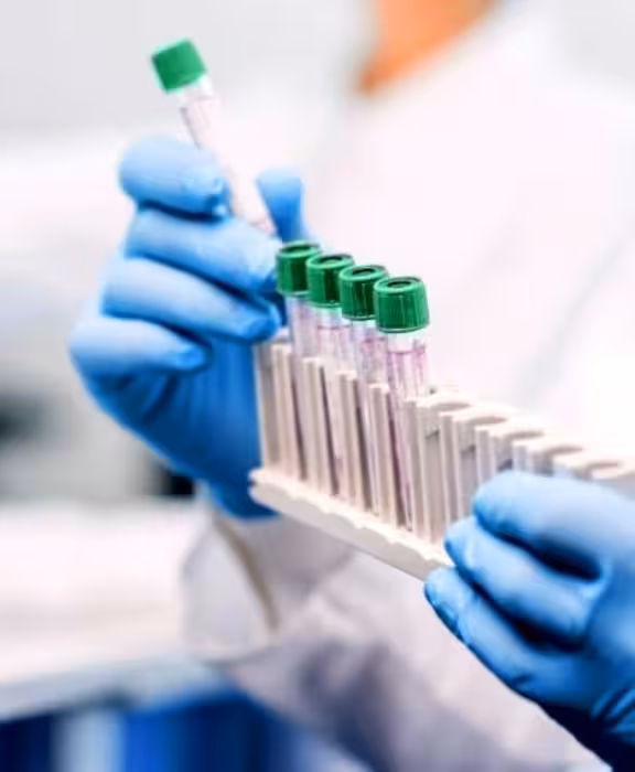 Private on-site lab testing London Bridge