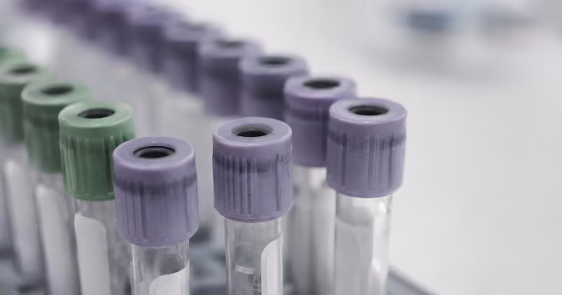 Private Salmonella testing