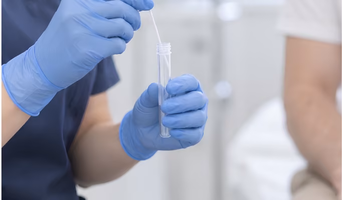 Clinician placing a swab sample into a test tube for chlamydia testing