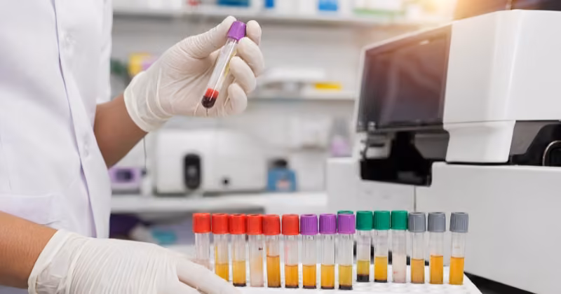 Private STI testing in London